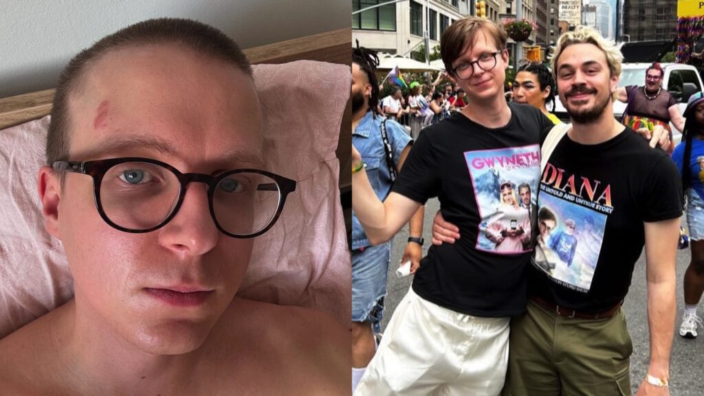 Linus Karp following a homophobic attack and then Linus and his partner Joseph Martin